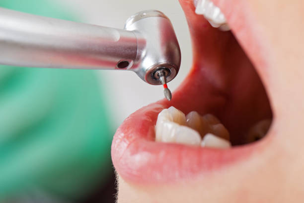 Best Cracked Tooth Emergency Dentist  in Honea Path, SC